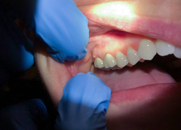 Best Emergency Dental Surgery in Kingston, OK