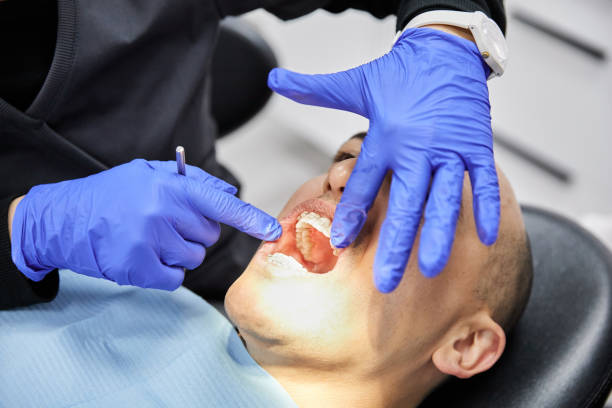 Best Emergency Tooth Extraction in Kingston, OK
