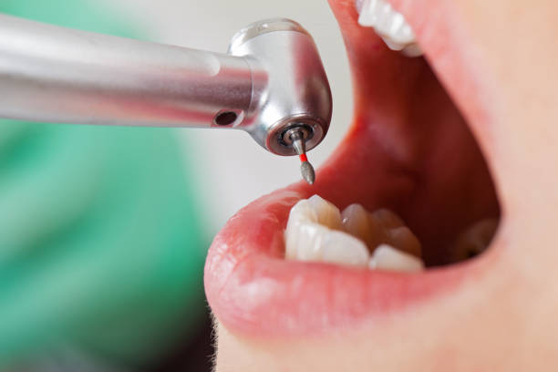 Best Weekend Emergency Dentist in Kingston, OK
